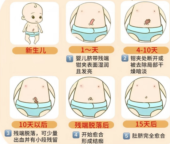新生儿科谢颖”脐“实很简单90.png