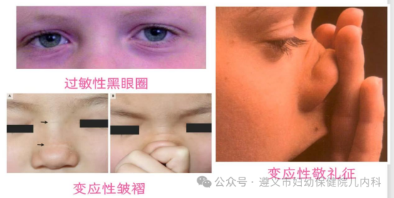 孩子咳嗽、流涕是感冒了吗?(1)392.png