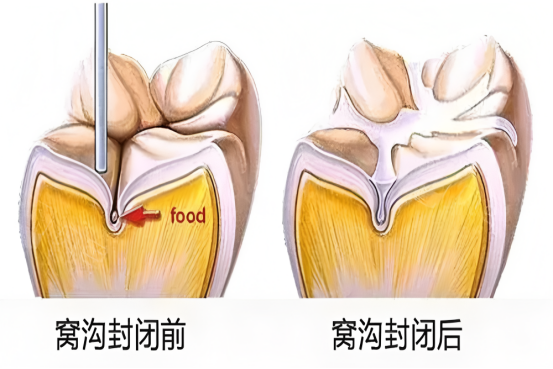 科普文章-口腔科250.png