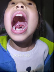 扁桃体治疗宣传(宣传科)675.png