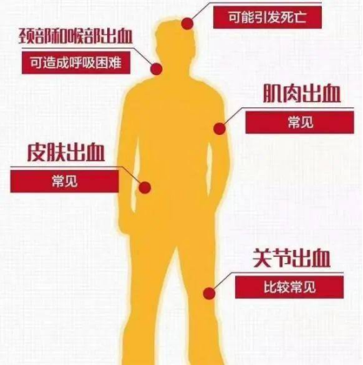 血友病--杨江权 -2508.png