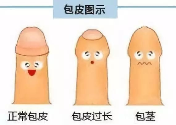 关于包皮这些事293.png